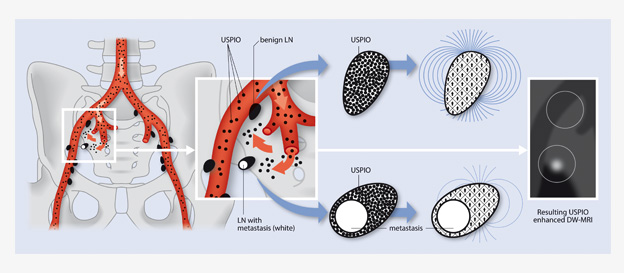 Lymphknoten 