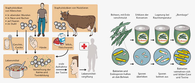 Mikroorganismen in Lebensmitteln